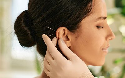 What is Acudetox Acupuncture? A Beginner’s Guide to Ear Acupuncture