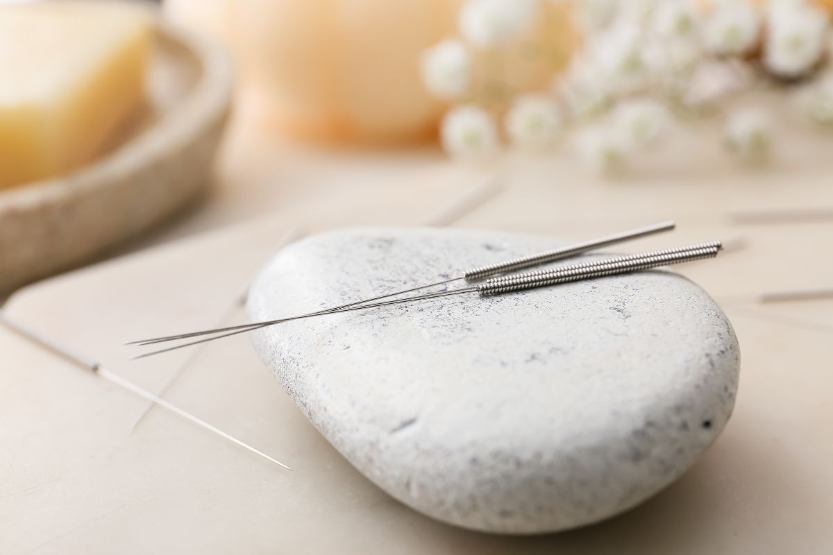 Acudetox Acupuncture A Gentle Path to Healing in Addiction Recovery